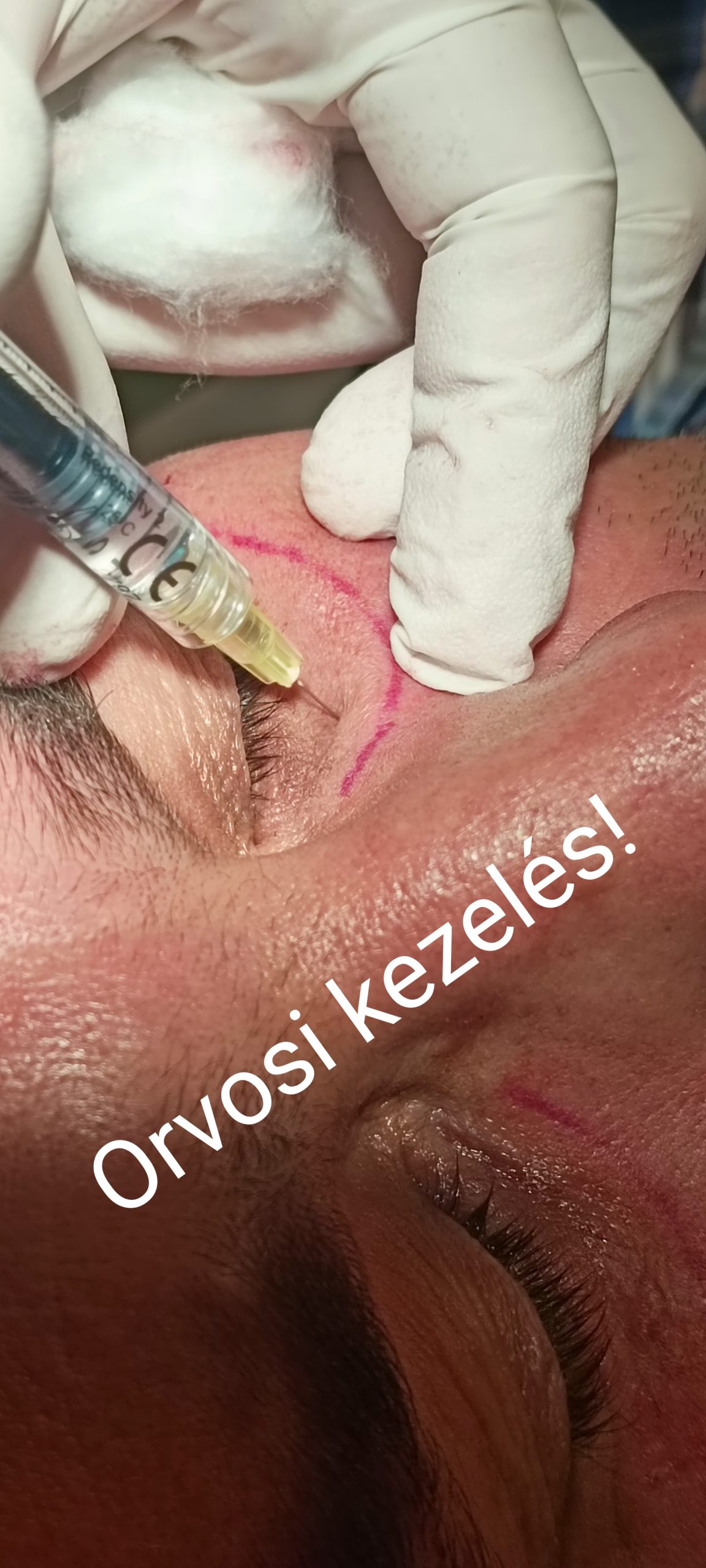 Schmelás Attila, VIVACEPÉCS. bőrgyógyászpécs, lézerpécs, arcfiataításpécs, szemkörnyék kezeléspécs